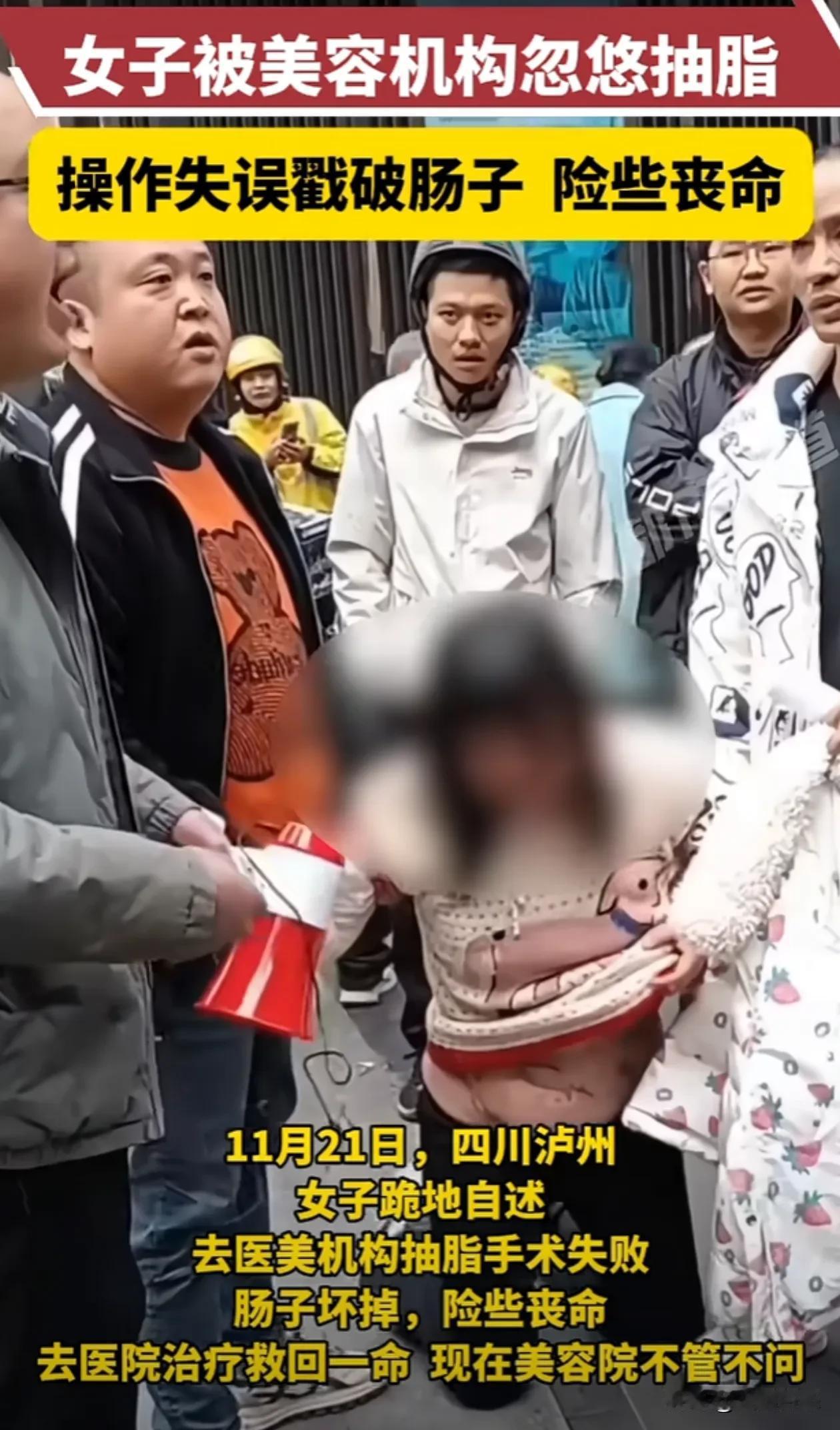泸州一女子做抽脂，被戳破肠子，差点命没了
2024年11月21日，四川省泸州市一