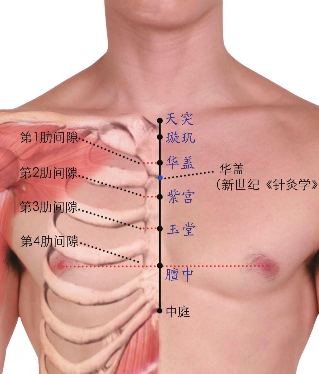 天突
位置与刺法：患者仰卧，枕头不宜过高，垫在胸椎上段。令患者抬头挺胸，充分暴露