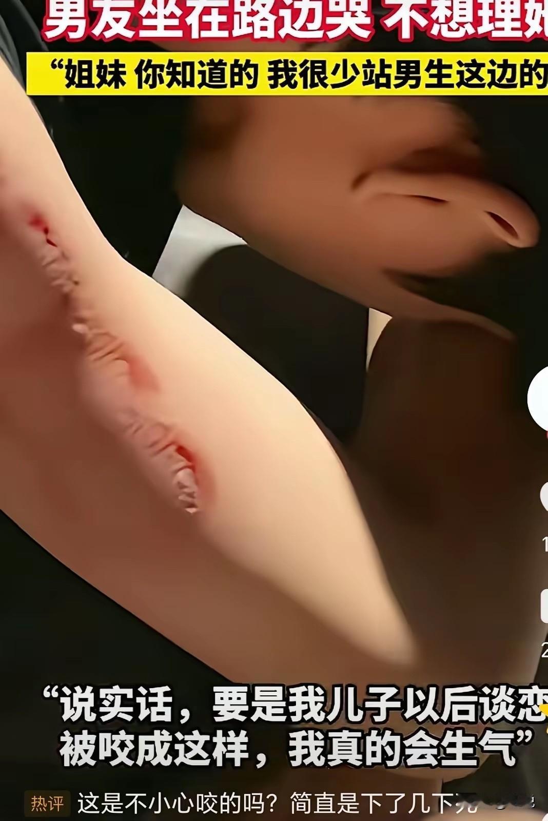 女孩子说，爱咬人是一种爱的表现，但这爱的也太多了…