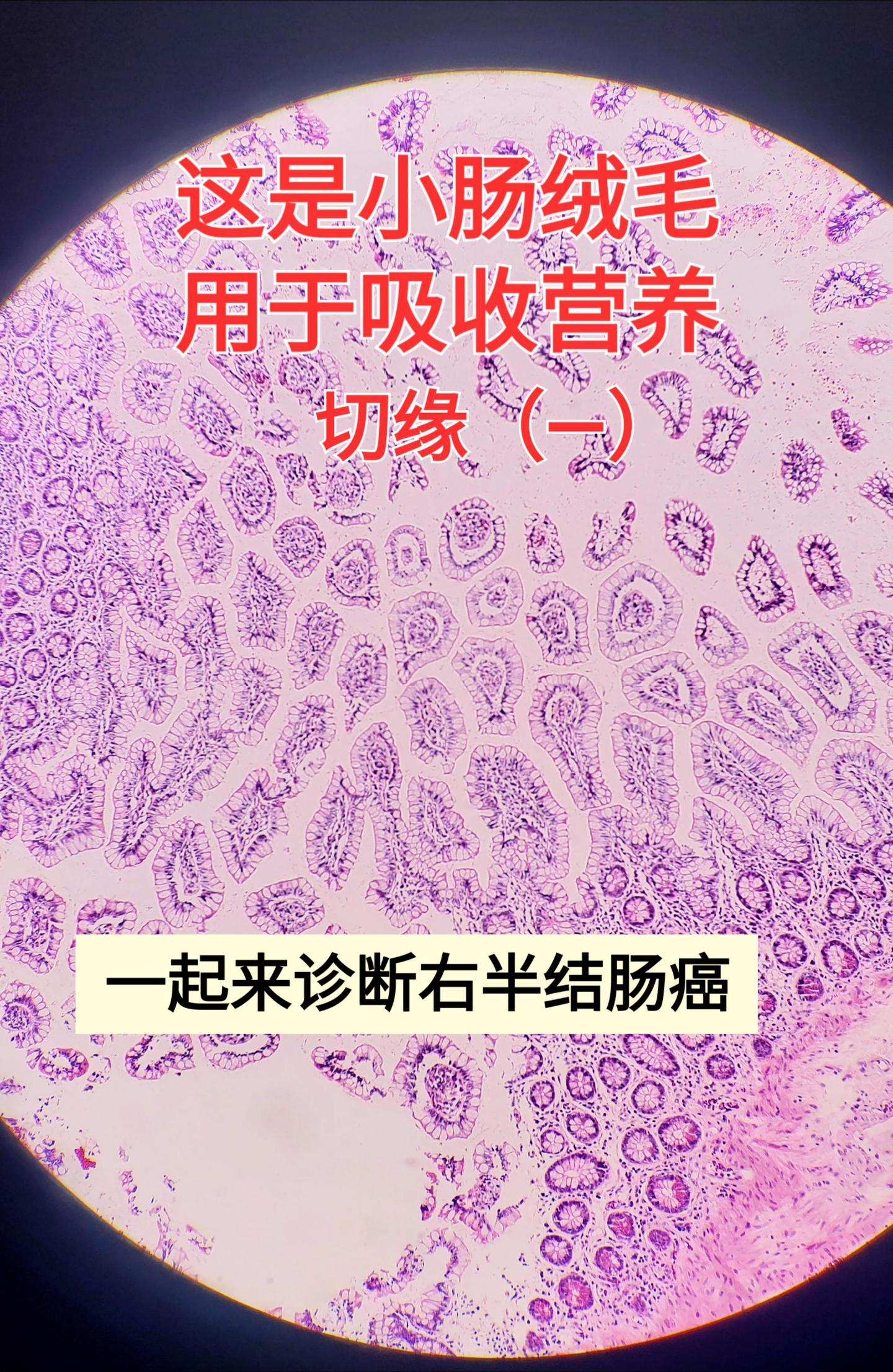 病理