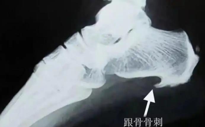 2019年，江苏一名男子因为腰伤脚痛等毛病，向公司多次请病假，公司一开始也同意了