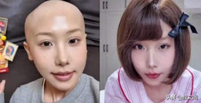 辽宁25岁博主“嘻嘻徐宝”去世，曾自述患癌前生活习惯