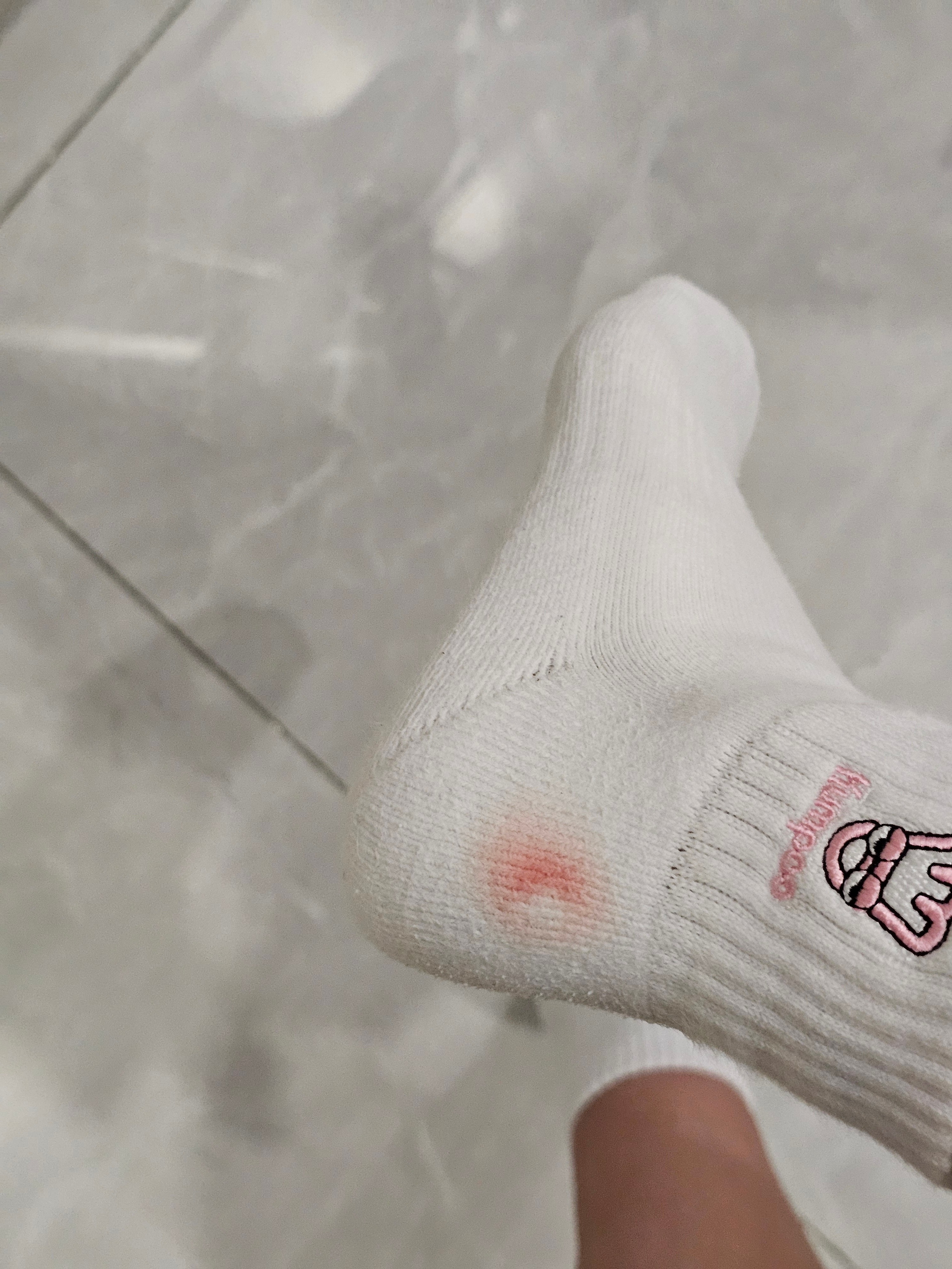 坏消息，脚后跟磨破了