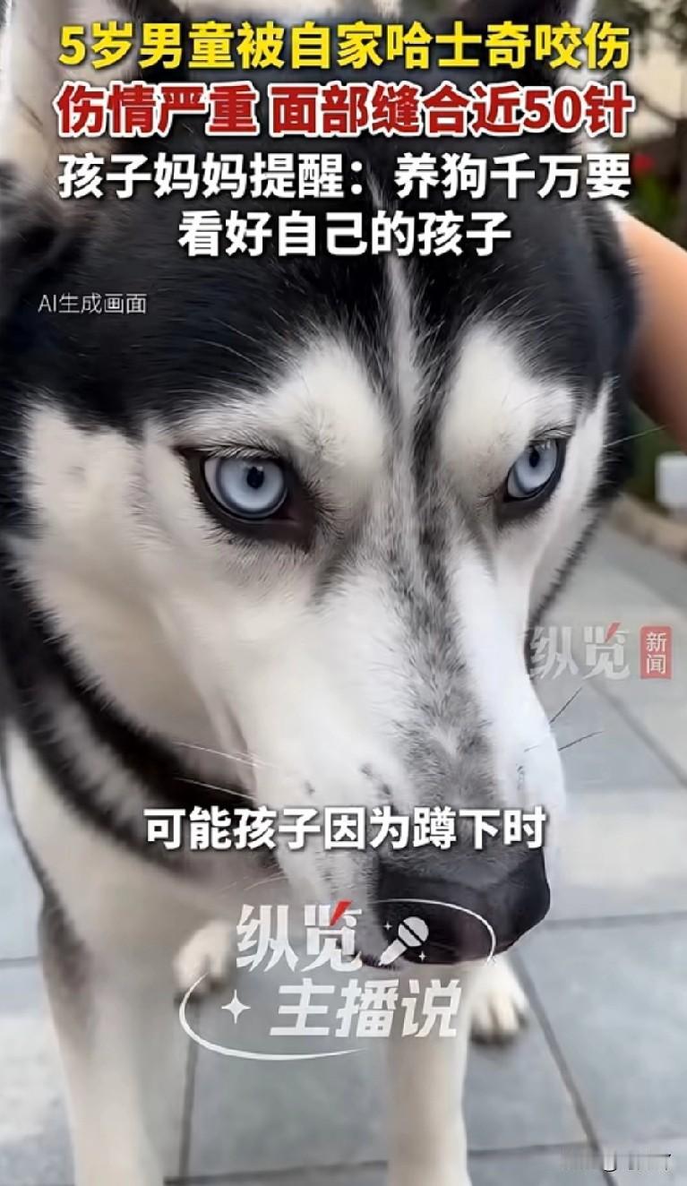 5岁男童被自家哈士奇咬伤，脸和脖子一共缝了50多针。不知道那些口口声声说“我家的