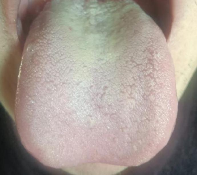 跑了一千公里来看诊，没想到十几块就能解决问题！重点还是在于对症调理了！

这个小