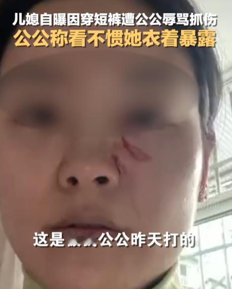 “清官难断家务事！”四川，一女子因天气热穿了条短裤，竟被50岁公公指着鼻子骂“伤