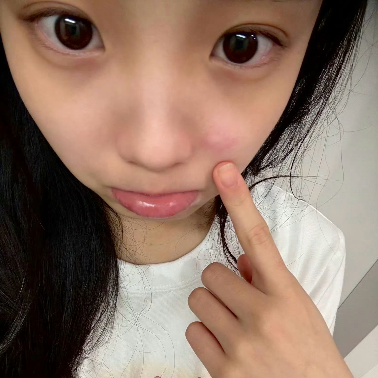 展示蚊子包的李沅禧 但完全被她那双素颜也blingbling的眼睛吸引….✨ ​