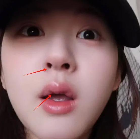 我去，这是真的吗？赵露思怎么鼻孔一大一小啊 ​​​