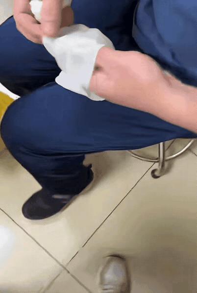 已经来晚了，只能截肢了～