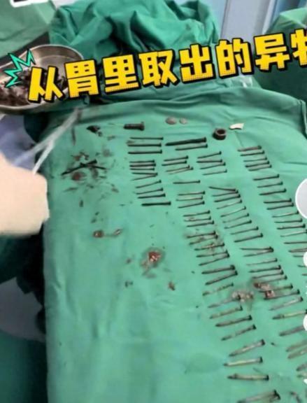 8月9日，云南一家医院的影像科阅片室内，气氛一下子紧张起来。当那张腹部CT图像传