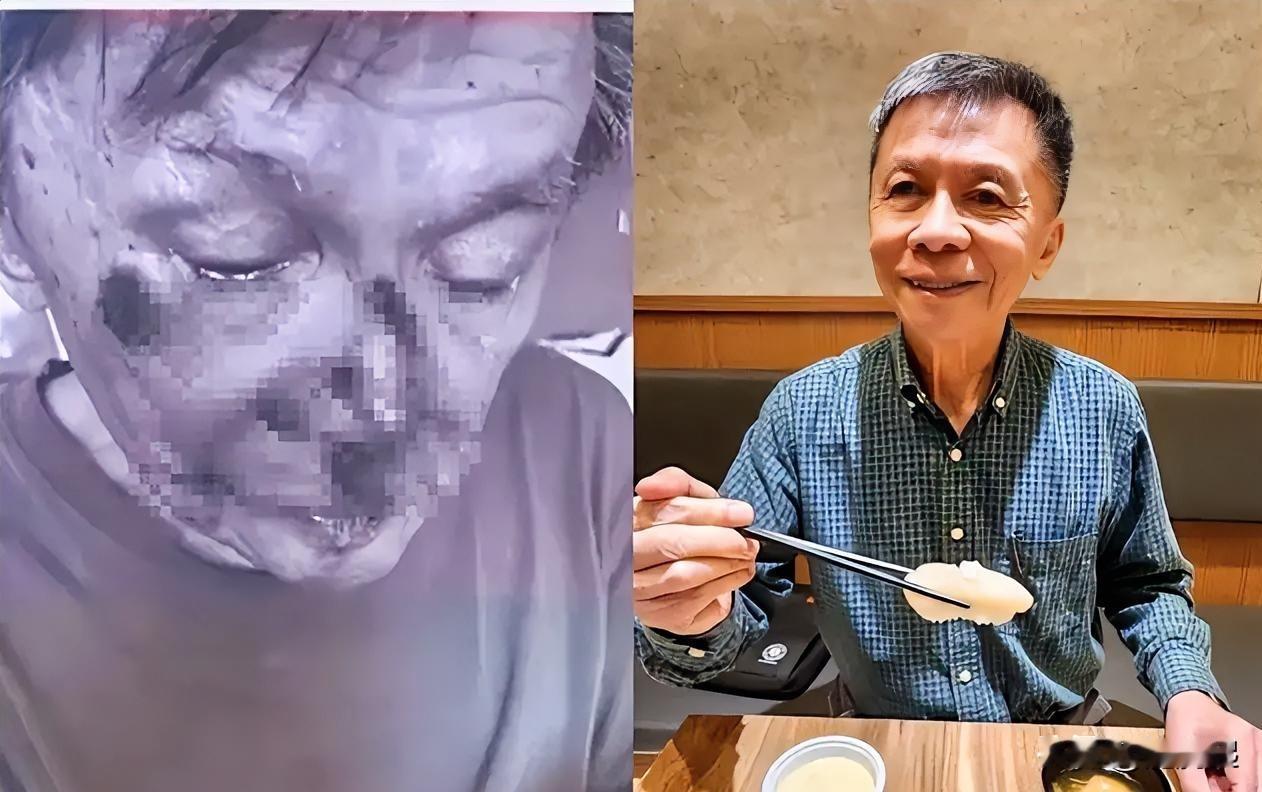 87岁沈富雄9月1日在《少康战情室》节目上自曝摔了一跤，感慨：我真的老了！
 