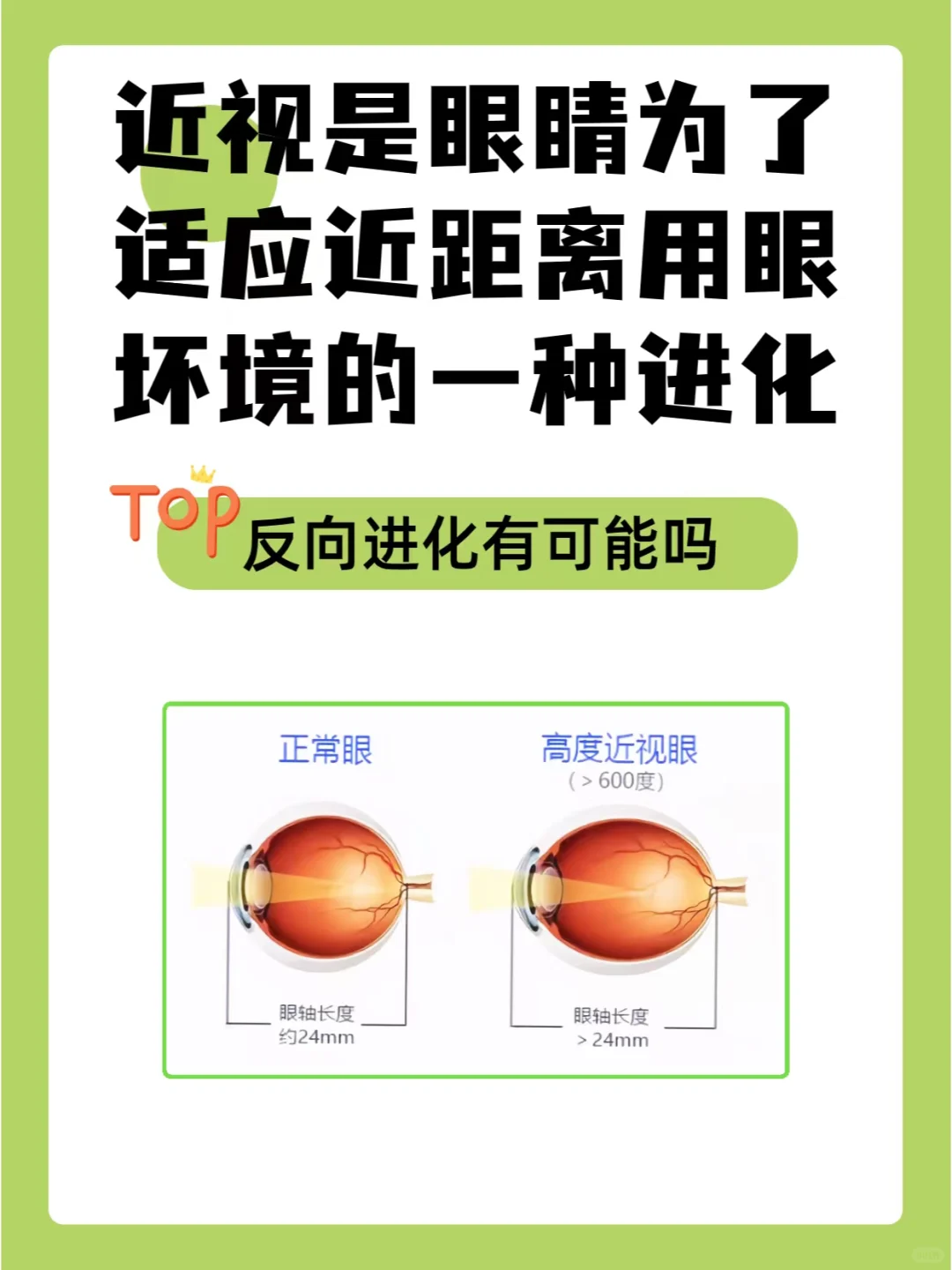 近视是眼睛为适应近距离用眼环境的一种进化