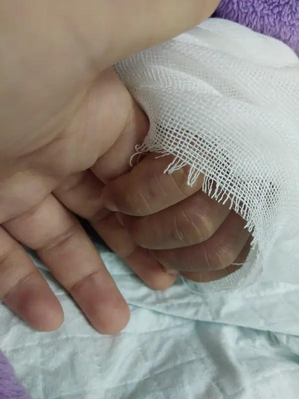 1月21日浙江，5岁女孩木板上玩耍不慎摔倒致骨折，老师将女孩扶到一边独自坐着再没