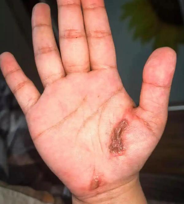 4月29日，贵州遵义一女子边充电边玩手机时突遭电击。长达数分钟，她嘴角流血、全身