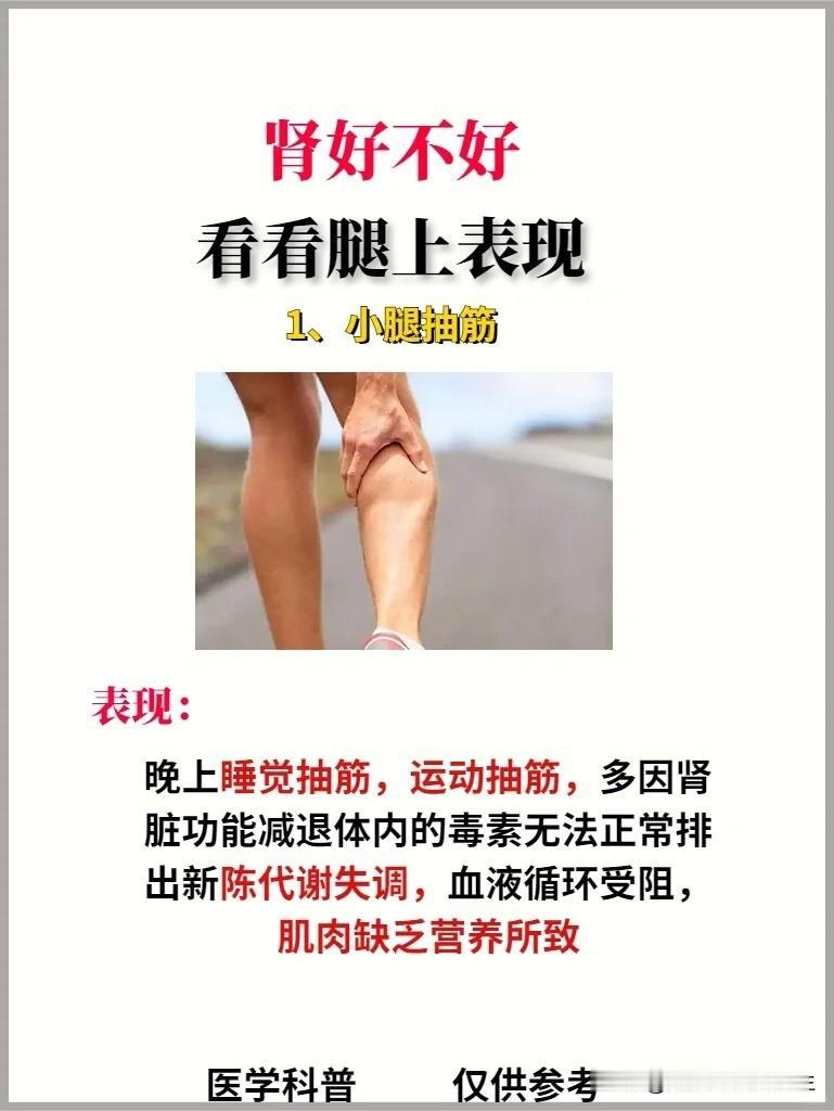 【肾好不好，看看腿上的表现】



1、小腿抽筋


2、小腿酸胀


3、双腿