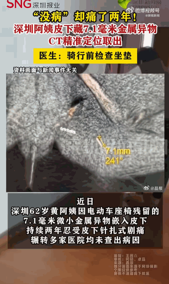 无病一身轻！广东深圳，一62岁的阿姨这两年过得可谓是求生不得、求死不能，她隐私部