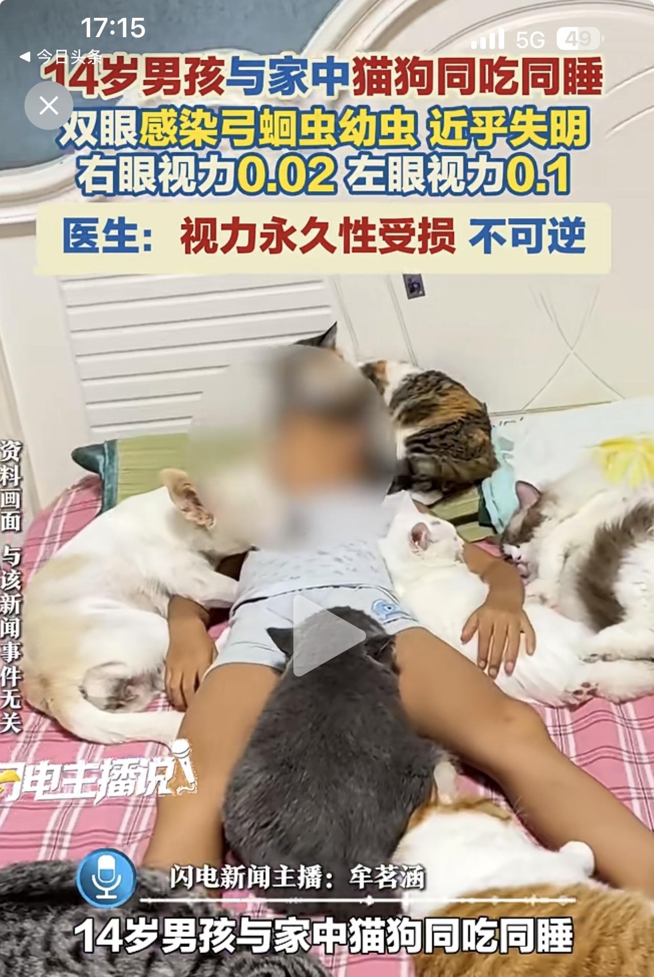14岁男孩与宠物猫狗过于亲昵，不幸感染弓蛔虫幼虫，导致双眼视力永久性受损！近乎失