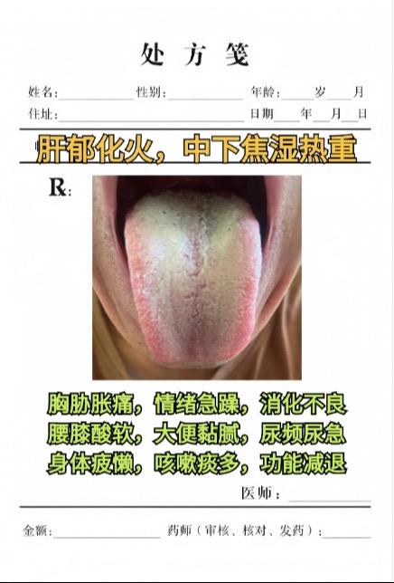 #舌苔辨证 #中医养生 #医学科普