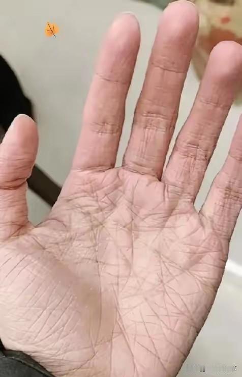 看这2只手，哪个不太正常？