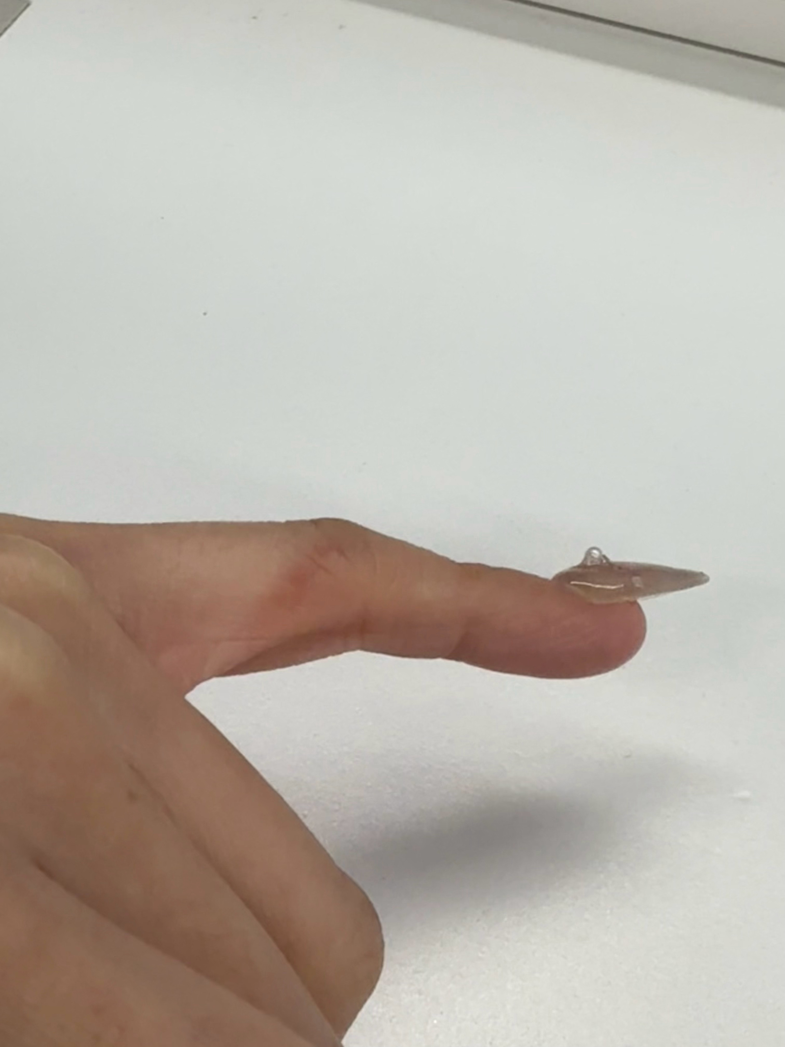 很好奇一个问题，大家因为玩手机都落下了什么不可逆的小毛病？我昨天突然发现左手小拇