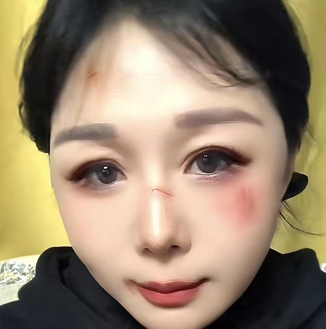 家人们，我今儿可干了个糊涂事儿，赌输了整整9万，还把车给押了！回家后老公气得让我