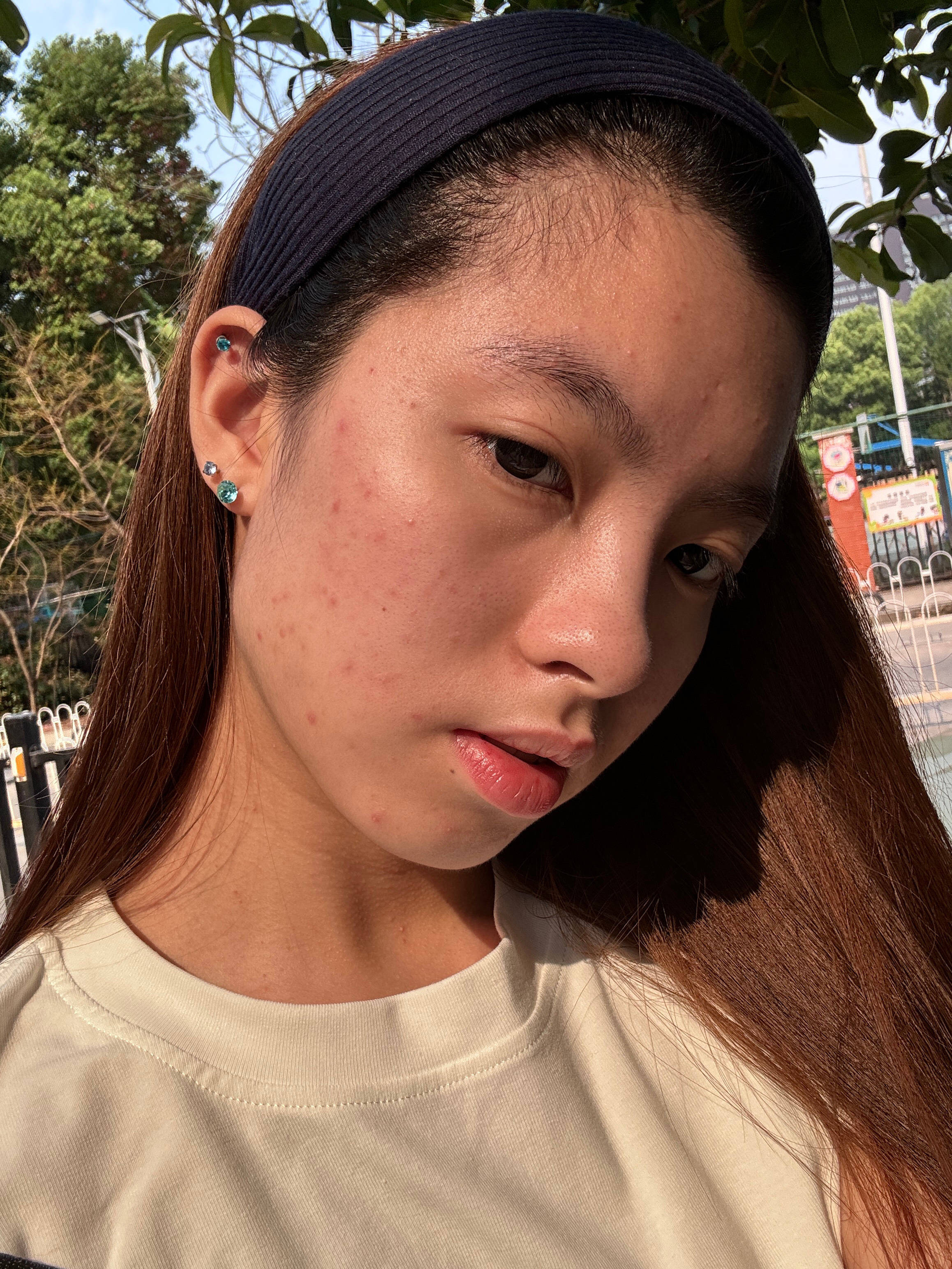 能不能对我好点…^_^别长痘好不好 ​​​