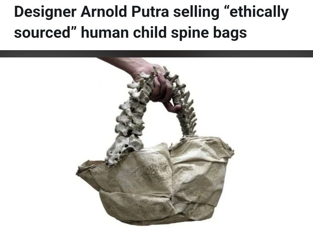 热知识，北美这种人骨收藏是合法的。美国斩杀线现象