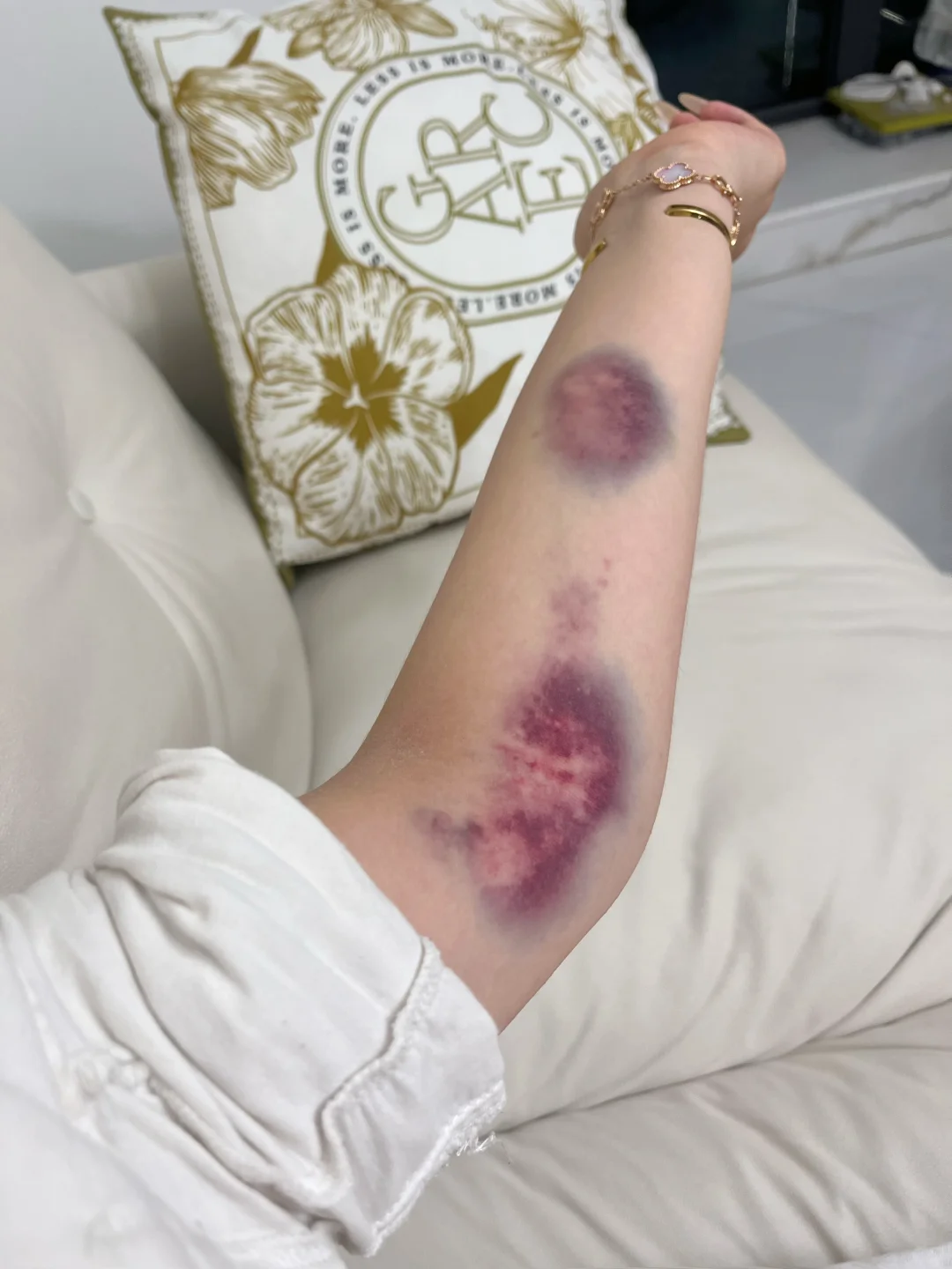 不纠正动作的后果就是这样