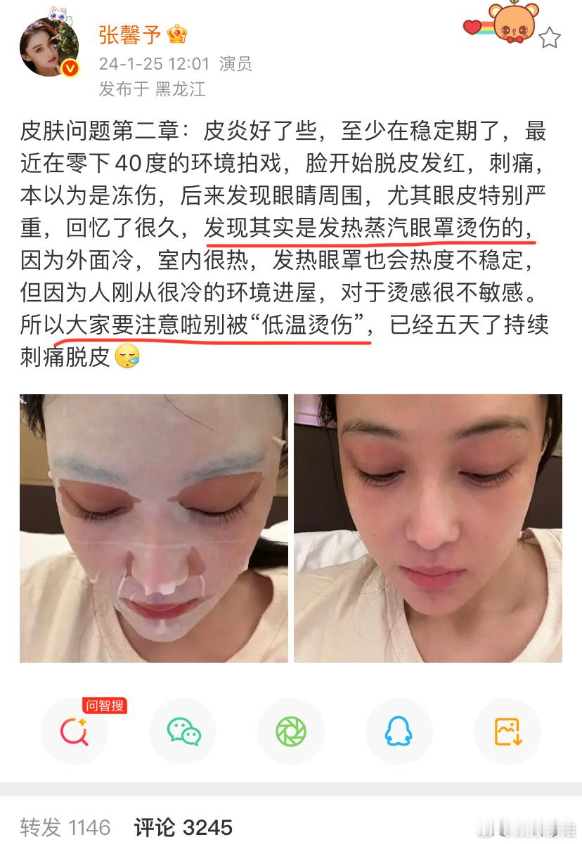 张馨予也被蒸汽眼罩烫伤过 张馨予评论杨幂：“我也被烫伤过，这是低温烫伤，一定小心