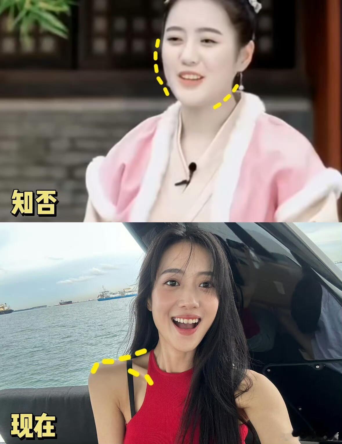 王梓薇瘦了50斤从130斤瘦到80多斤，165的身高这体重真的太轻了，还是稍微圆