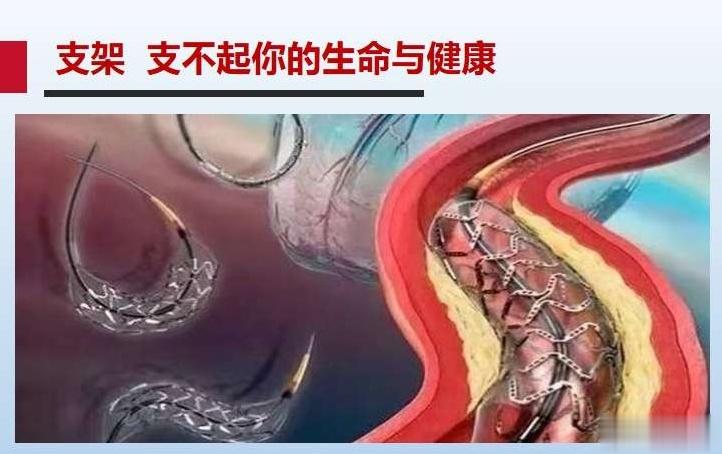 ⁉️什么是冠状动脉狭窄💔【冠状动脉狭窄】是指心脏的冠状动脉粥样硬化引起的冠状动