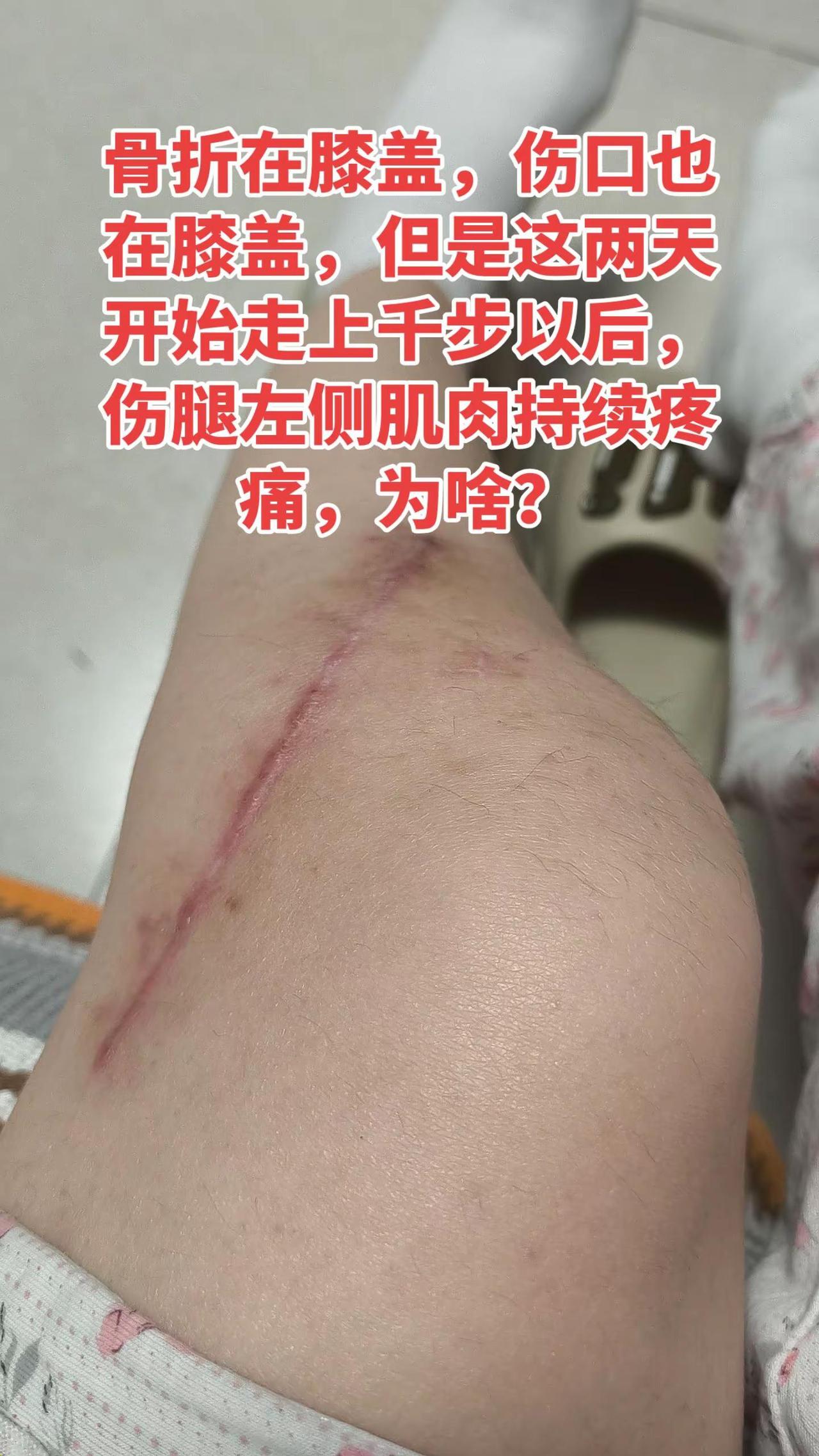 四个月了，走几千步算多还是少？