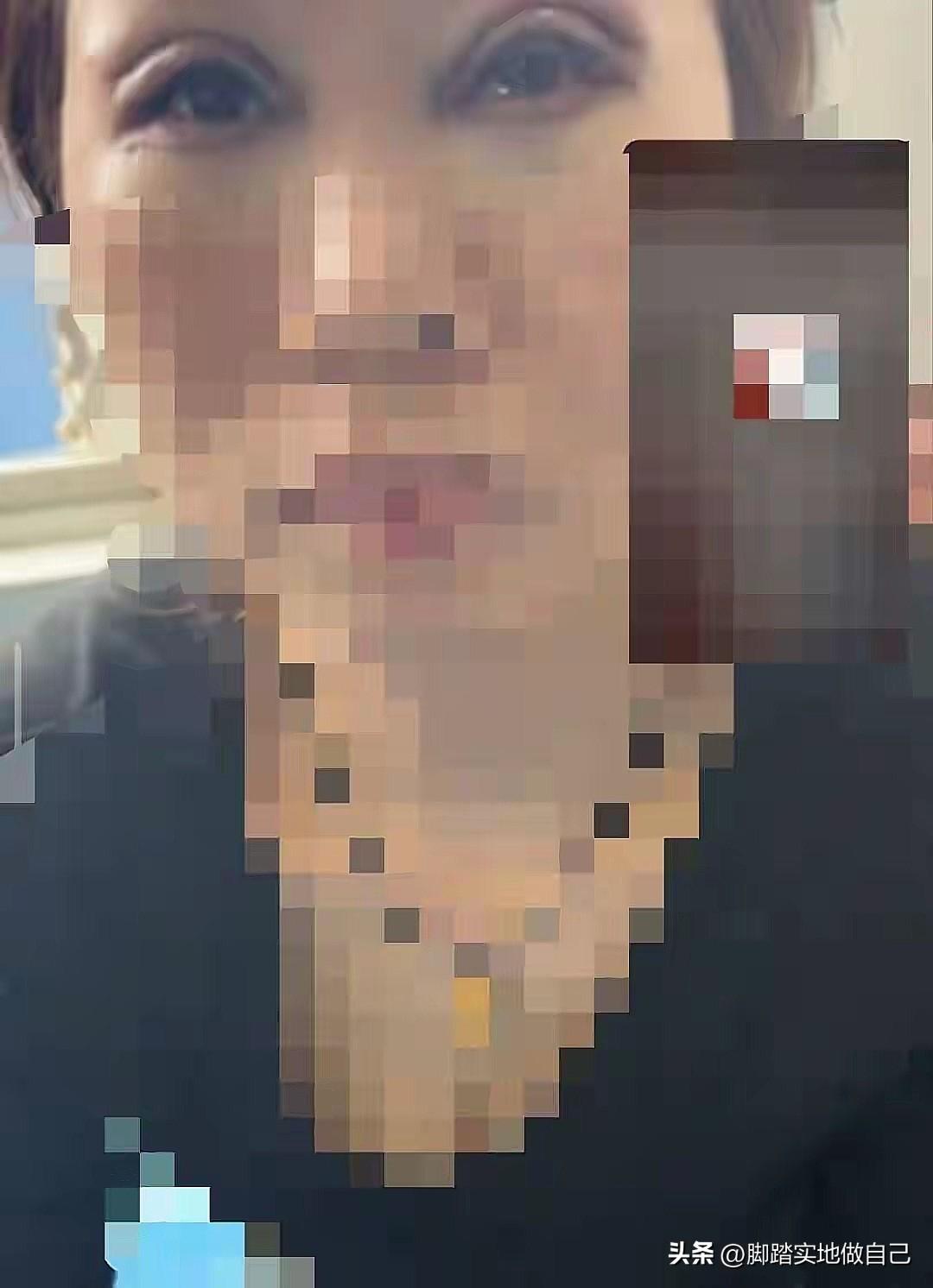 榆林姐妹们警惕！315刚曝光，非法医美太吓人了！
 
家人们，315曝光的榆林非