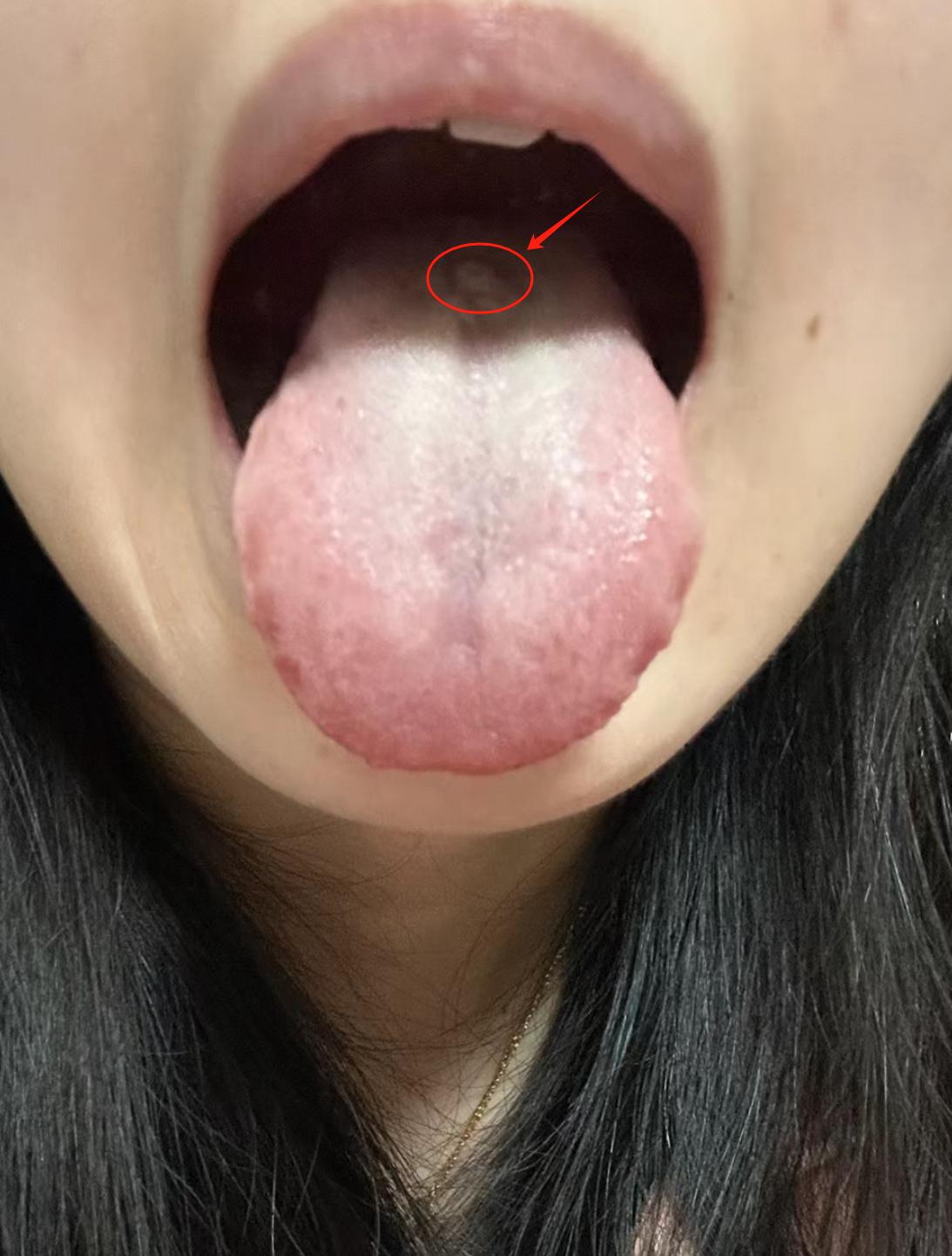 天天说男人，天天说男人，今天出场一位美女
才20来岁湿气重不说，看看你妇科问题[