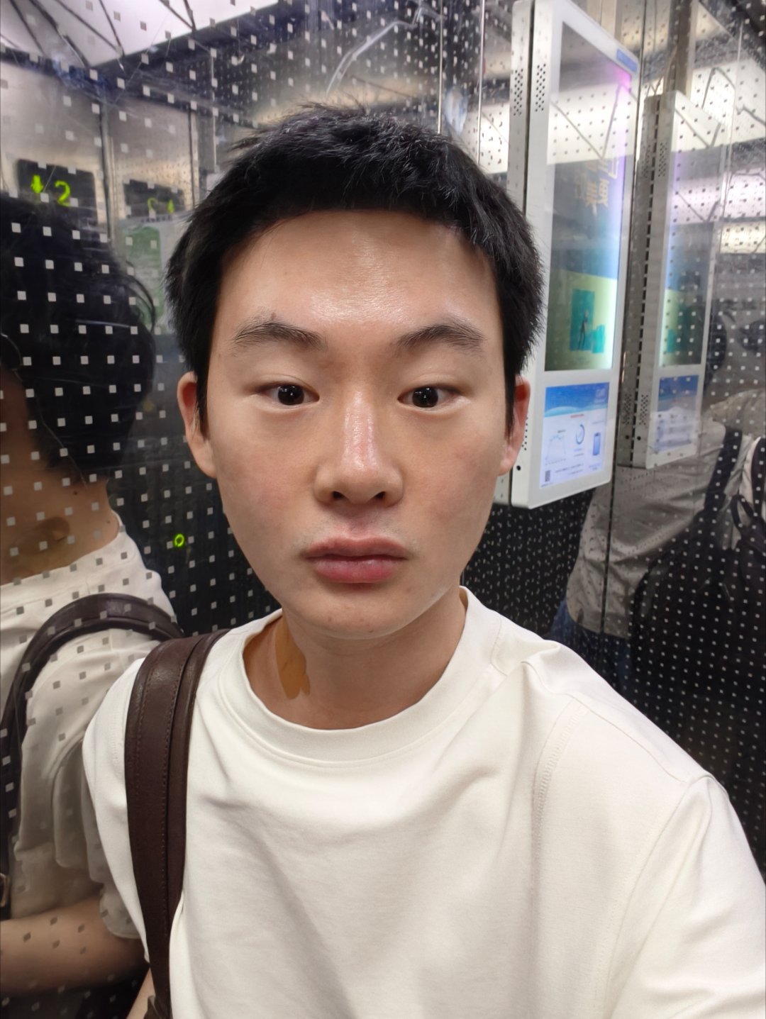 雅丰这个针头真的很夸张，打嘴巴竟然能做到无痛，只有扎深的时候才有一点质颜填平了口