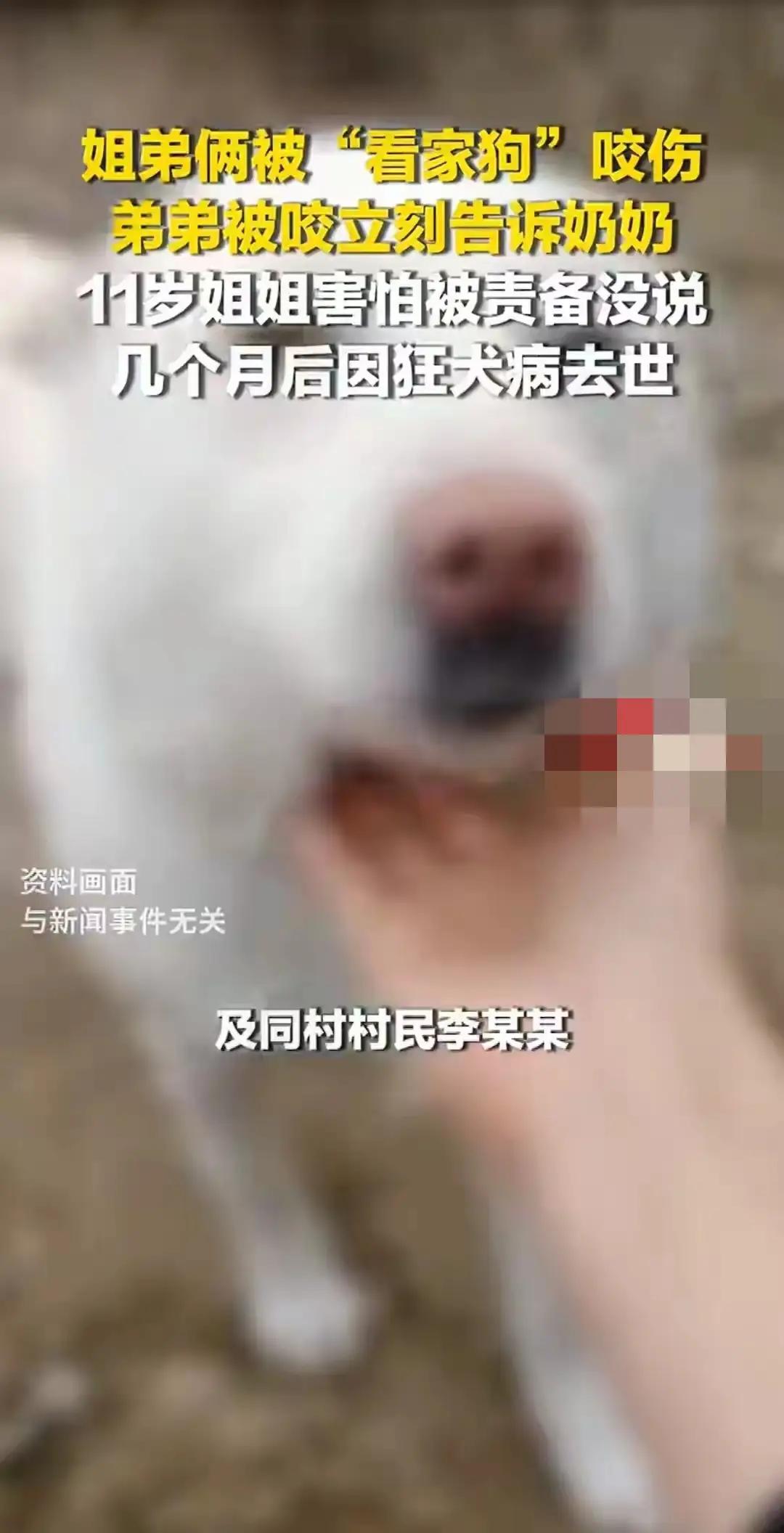 一声隐瞒，阴阳两隔！狂犬病离世女孩的悲剧，敲醒所有人的安全警钟
 
去年12月，