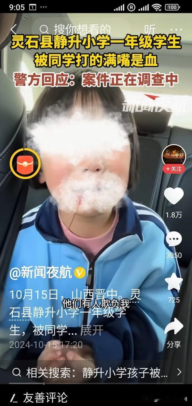 昨天在山西晋中，有个一年级的小女孩被八个同学给打了，嘴巴都流血了，特别让人心疼。