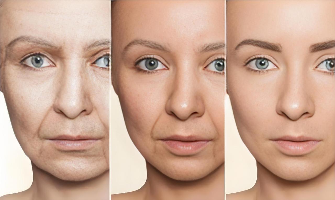 你愿意接受自然的衰老吗? 在当今“冻龄”“逆龄”盛行的时代，自然衰老仿佛成了忌讳