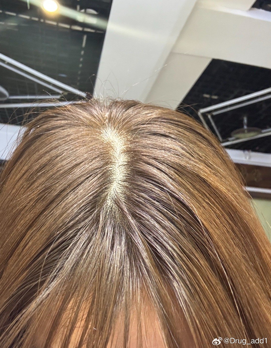 我妈给我染的超不均匀的头发 ​​​