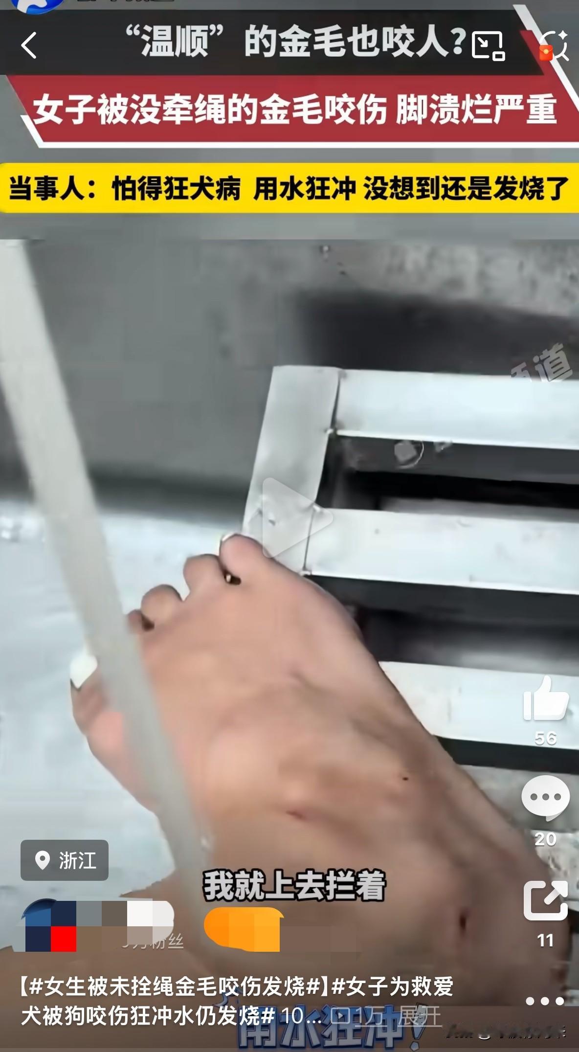 按规定拴绳养狗的人遭了殃，不栓绳的狗倒咬人了！

近日，浙江的李女士遭遇了“飞来