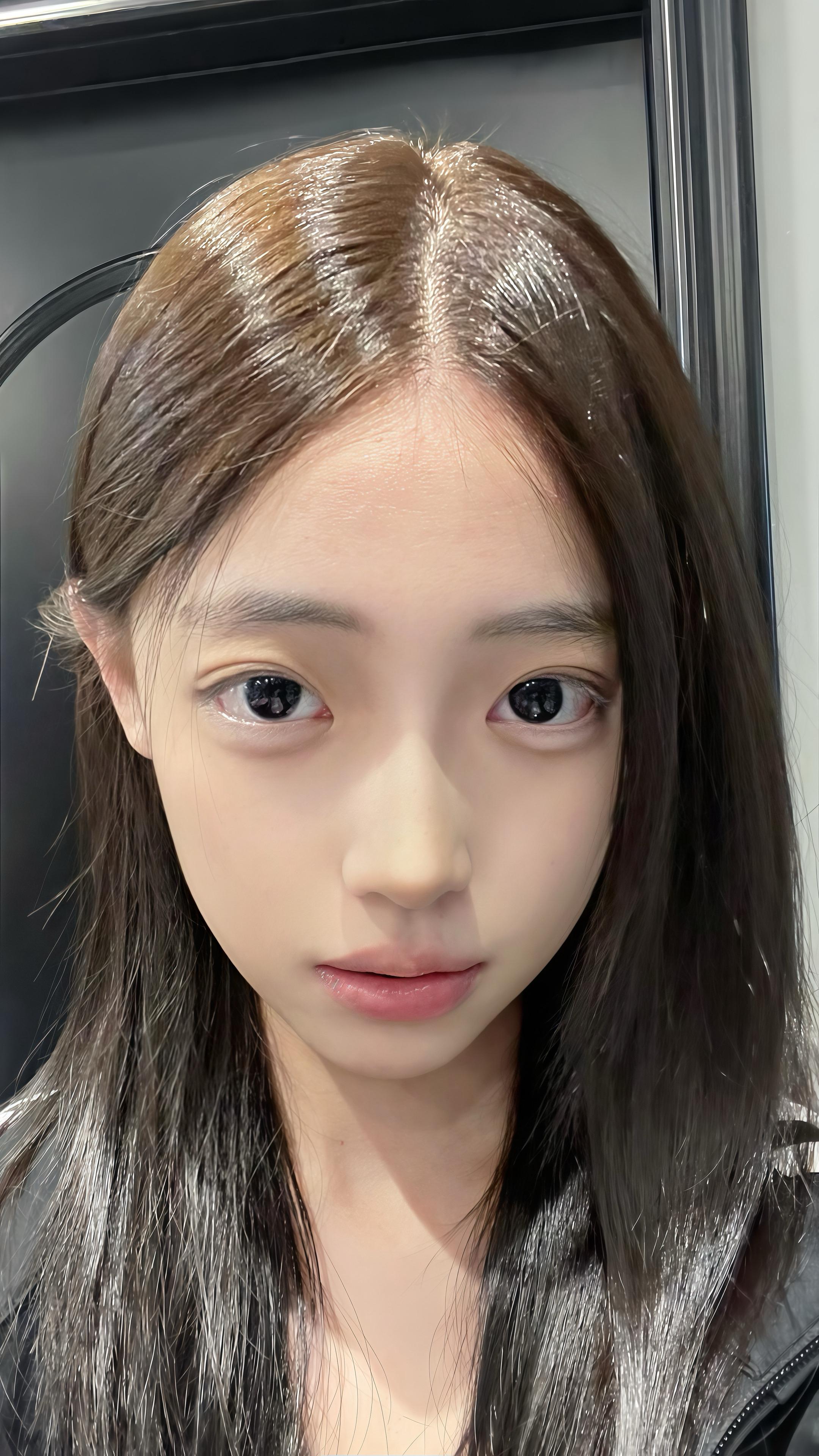 大顶光