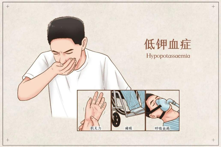 【催吐代价比你想的更致命！】吃撑了抠喉咙催吐，为了减重催吐……部分人认为催吐除了