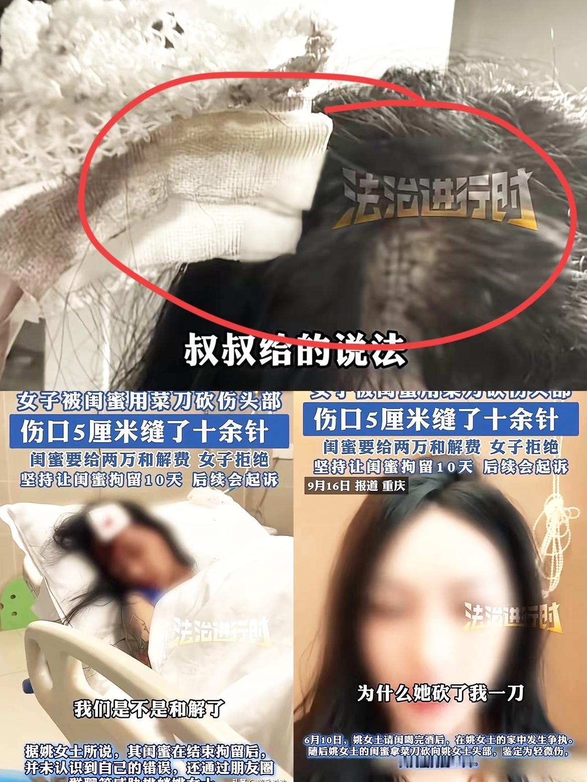 你能想象吗？
和闺蜜吃顿饭，
最后竟被
菜刀砍头！重庆的姚女士就碰上了这糟心事，