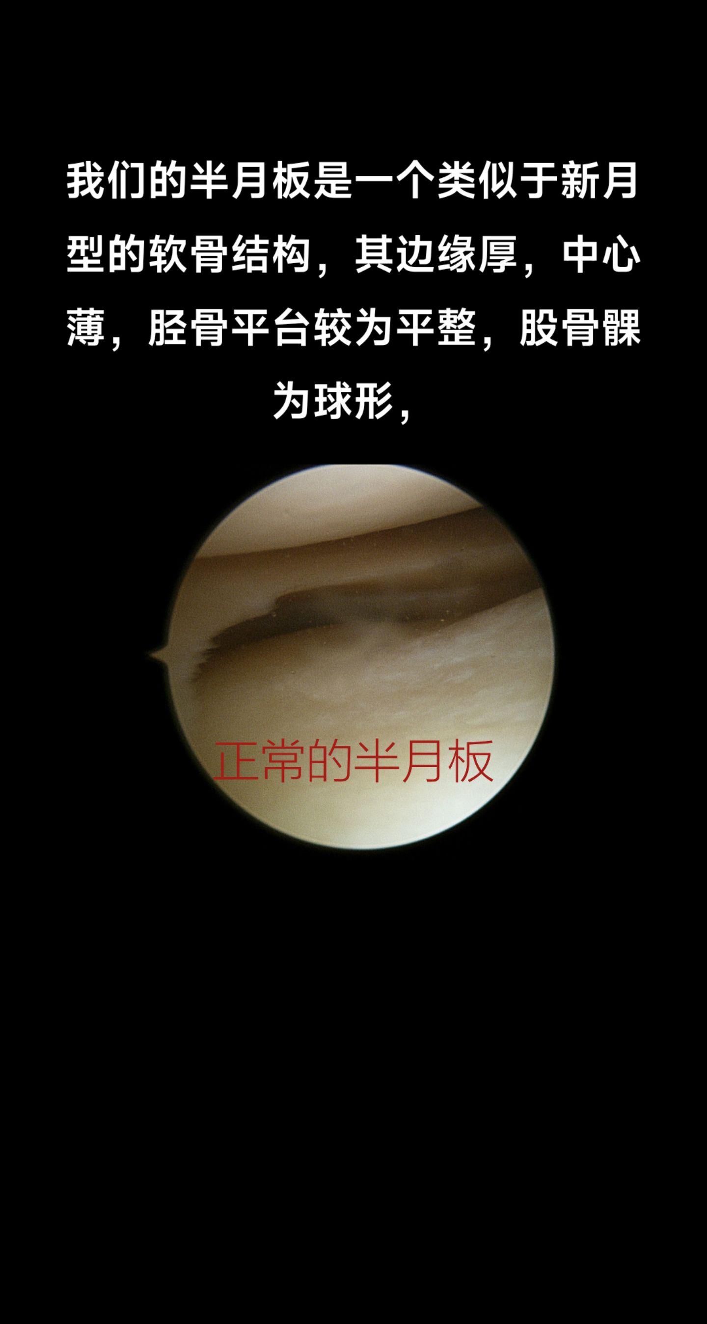 半月板的结构。