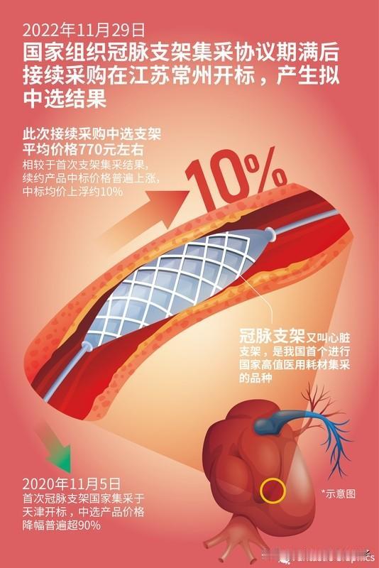 男子被植入6个支架后心脏骤停去世 42岁的国企员工陈先生，本有个幸福美满的家庭，