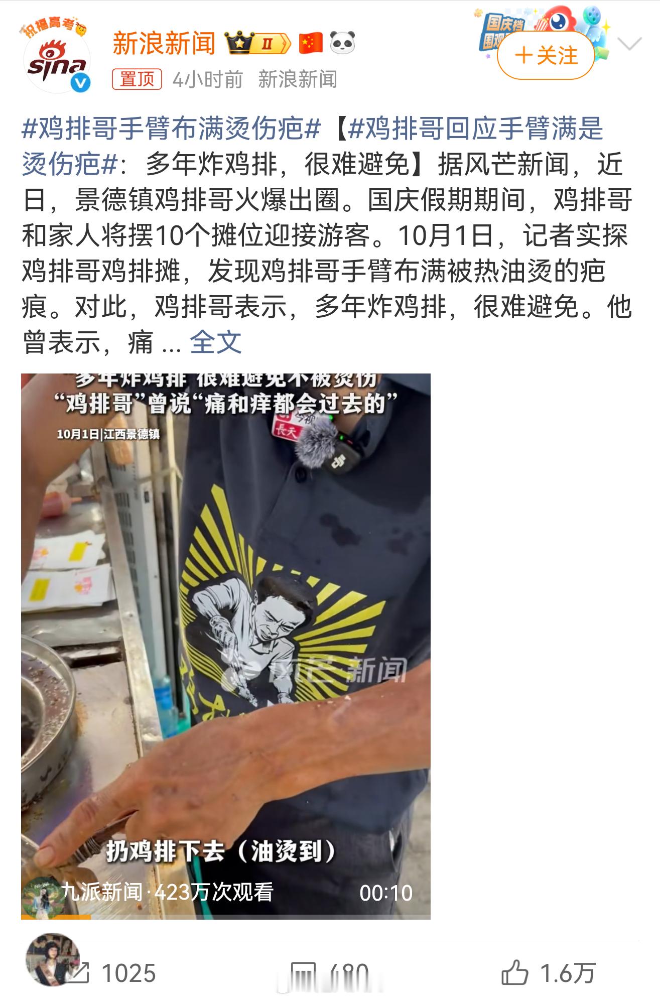 鸡排哥手臂布满烫伤疤没有人能够随随便便成功，这得挨多少打，才能够成角儿啊 ​​​