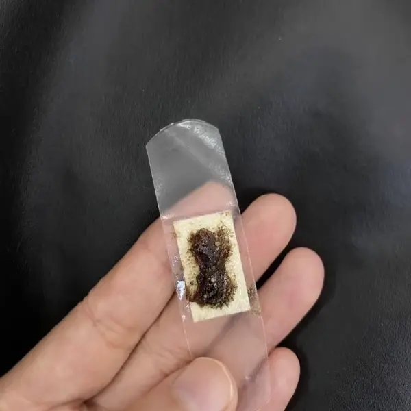 对付狗狗肿瘤，针对体表肿瘤，中兽医古方。对付狗狗肿瘤，针对体表肿瘤，中...