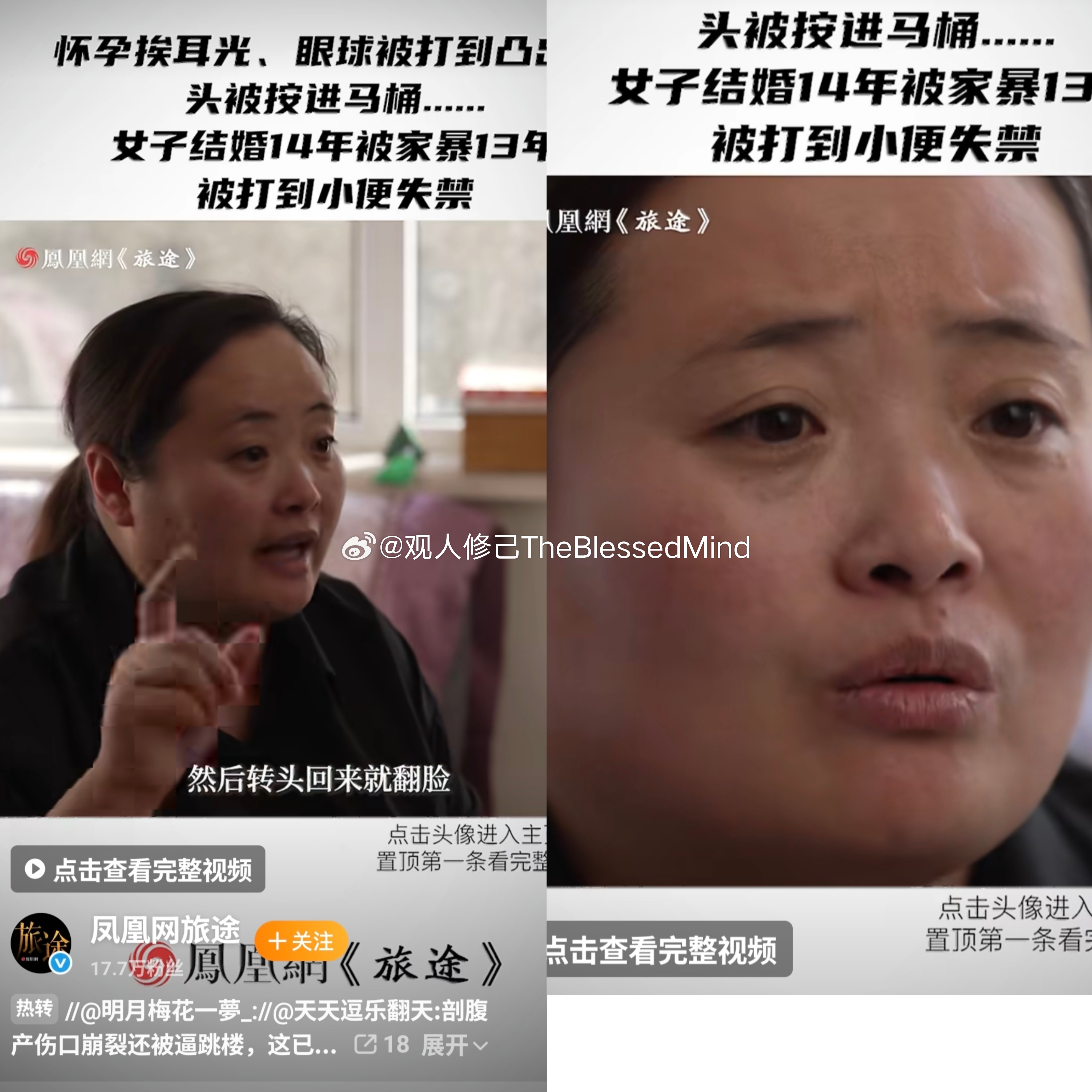 今天看到个被家暴的女子，典型面大鼻小，夫运缥缈，如果是这一类型的真不需要考虑婚姻