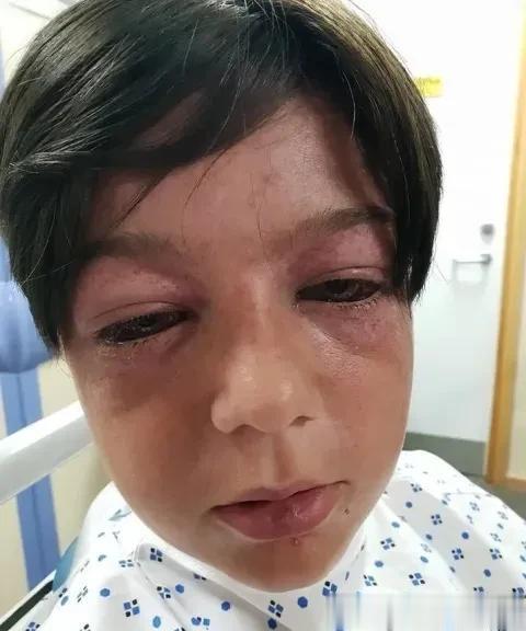 外媒曝光，据说美国一所学校发生的恶性霸凌事件，
照片中这名无辜的小学生，被霸凌者