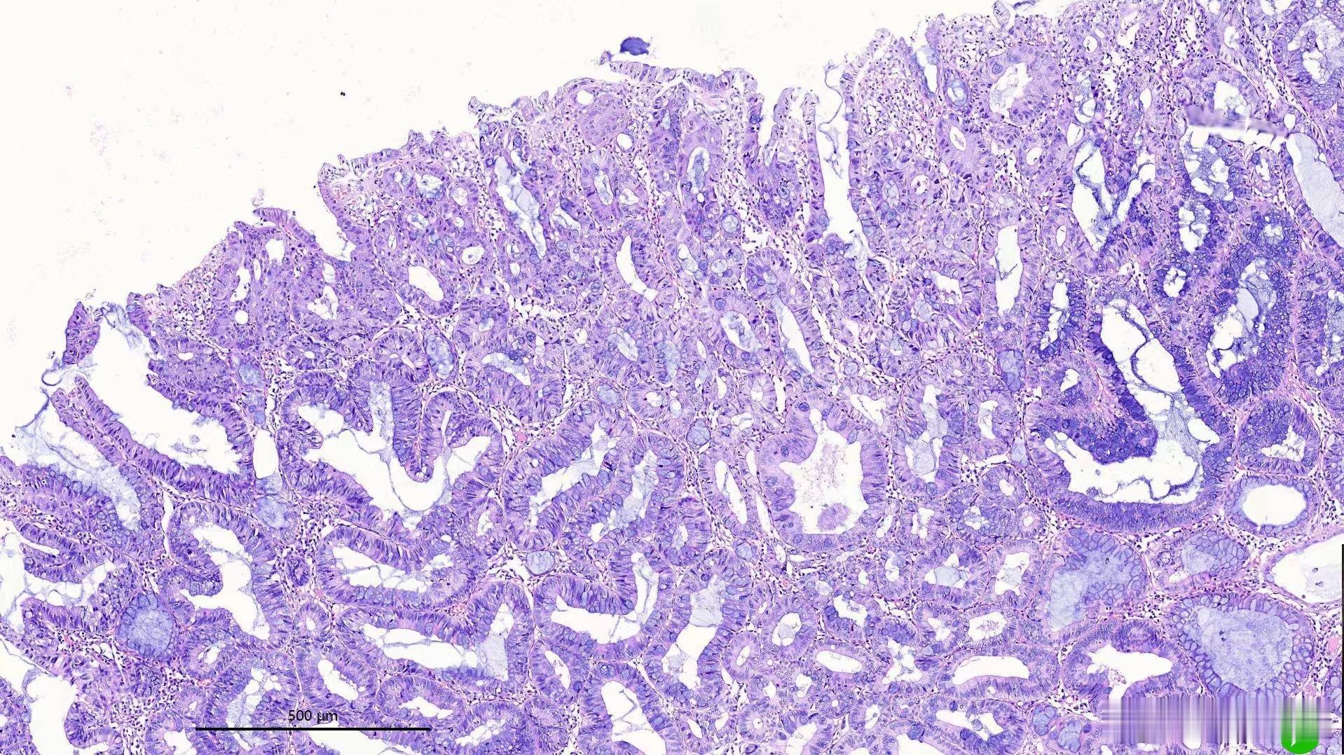 病理读片观察要点：一、先确认「基本信息」（读片前必做）1. 标本来源与部位：明确